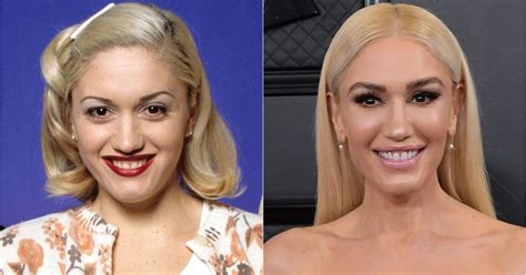 gwen stefani plastic surgery before and after